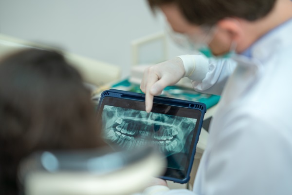 Signs Your Tooth May Need A Root Canal